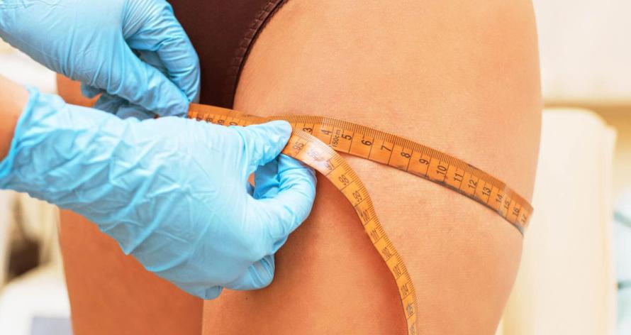 woman-before-procedures-doctor-measuring-her-hip-2025-10-14-09-44-25-utc-scaled